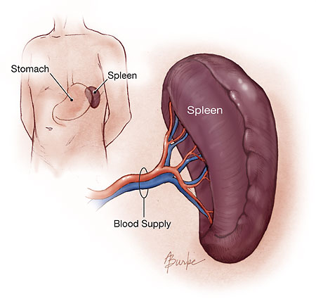 Spleen Why Does my Spleen Hurt?