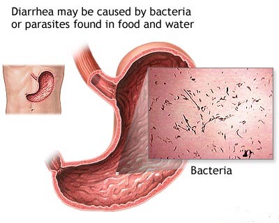 Diarrhea Why Does Diarrhea Burn  