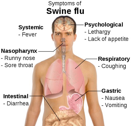 Swine Flu Symptoms Why Does Swine Flu Kill